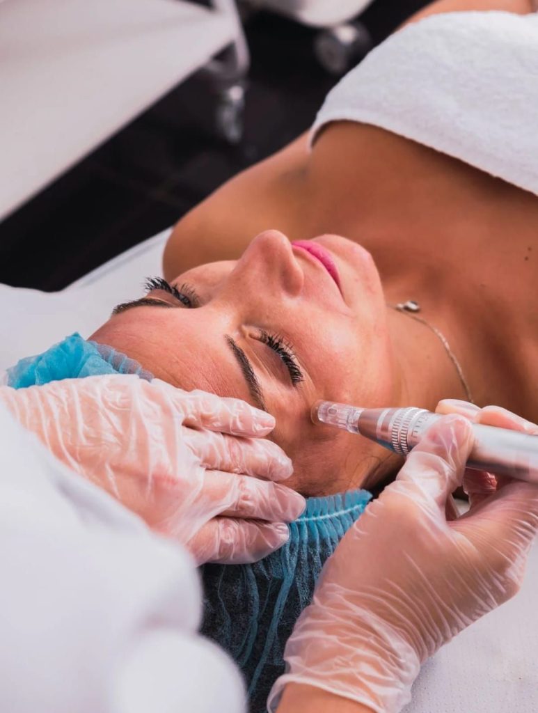 Tratamiento Dermapen