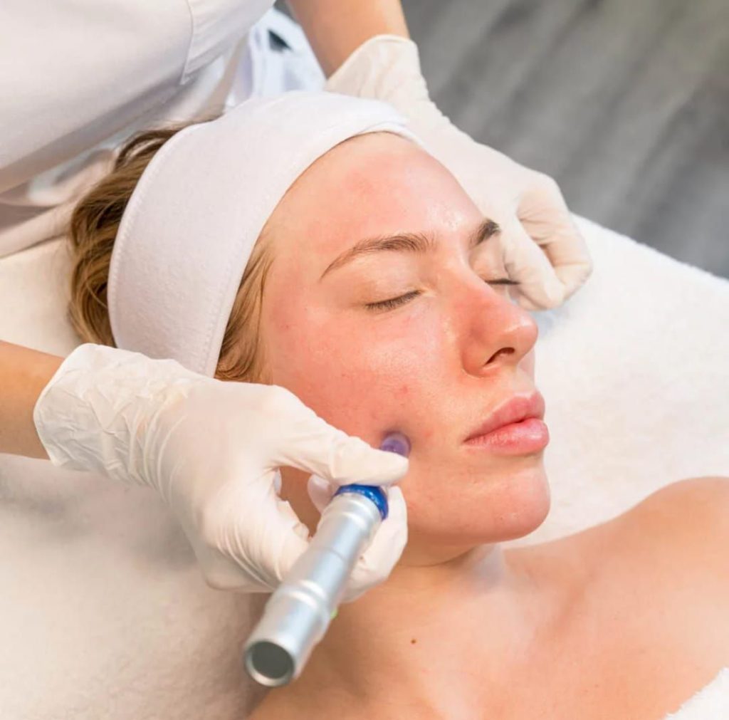 Tratamiento a domicilio Dermapen